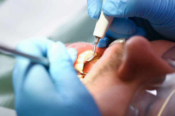 Best Emergency Dental Services for Seniors in Grabill, IN