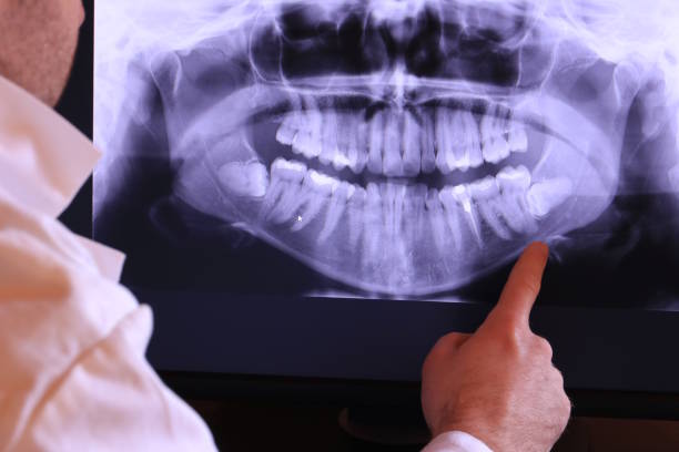 Best Emergency Dental Extractions in Grabill, IN