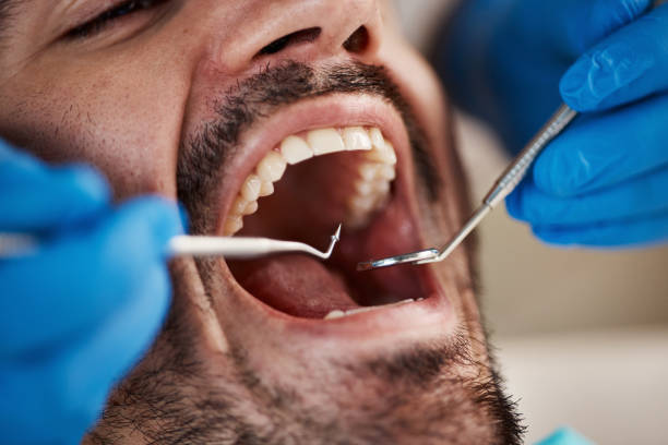 Best Emergency Cosmetic Dentistry in Grabill, IN
